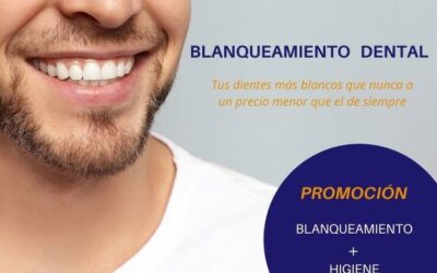 Blanqueamiento Dental ¿Qué hay que saber?