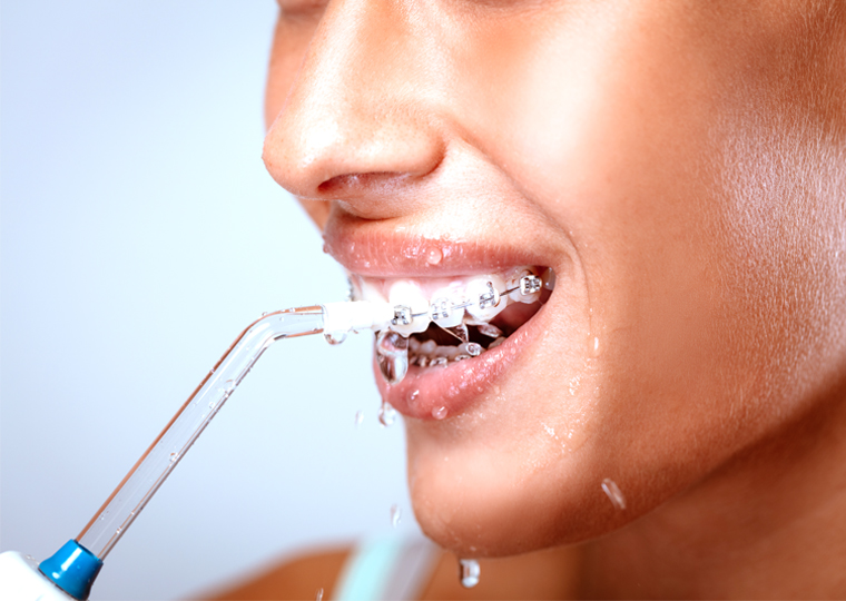 El irrigador bucal: cómo y cuándo usarlo para una salud dental óptima