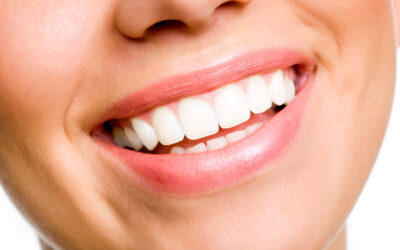 Consejos para antes y después de un blanqueamiento dental
