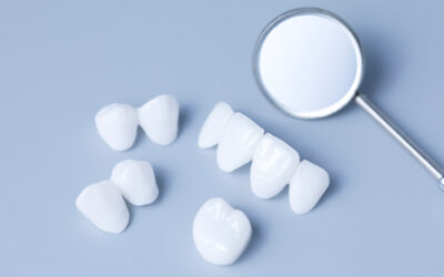 ¿Qué son las coronas dentales? Procedimientos y tipos