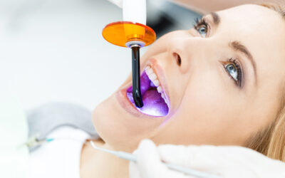 ¿Cuál es la mejor edad para realizarse un blanqueamiento dental?