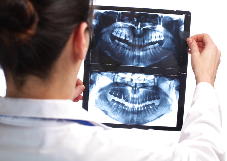 Las ventajas de la Ortopantomografía  en los tratamientos dentales