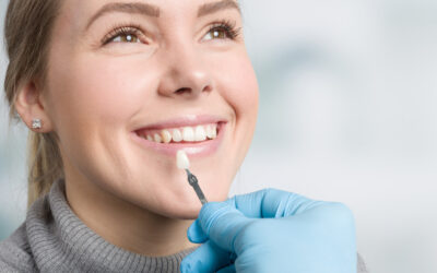 Mitos y realidades sobre las carillas dentales
