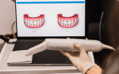 Diseño Digital de una Sonrisa 4.0: lo último en estética digital