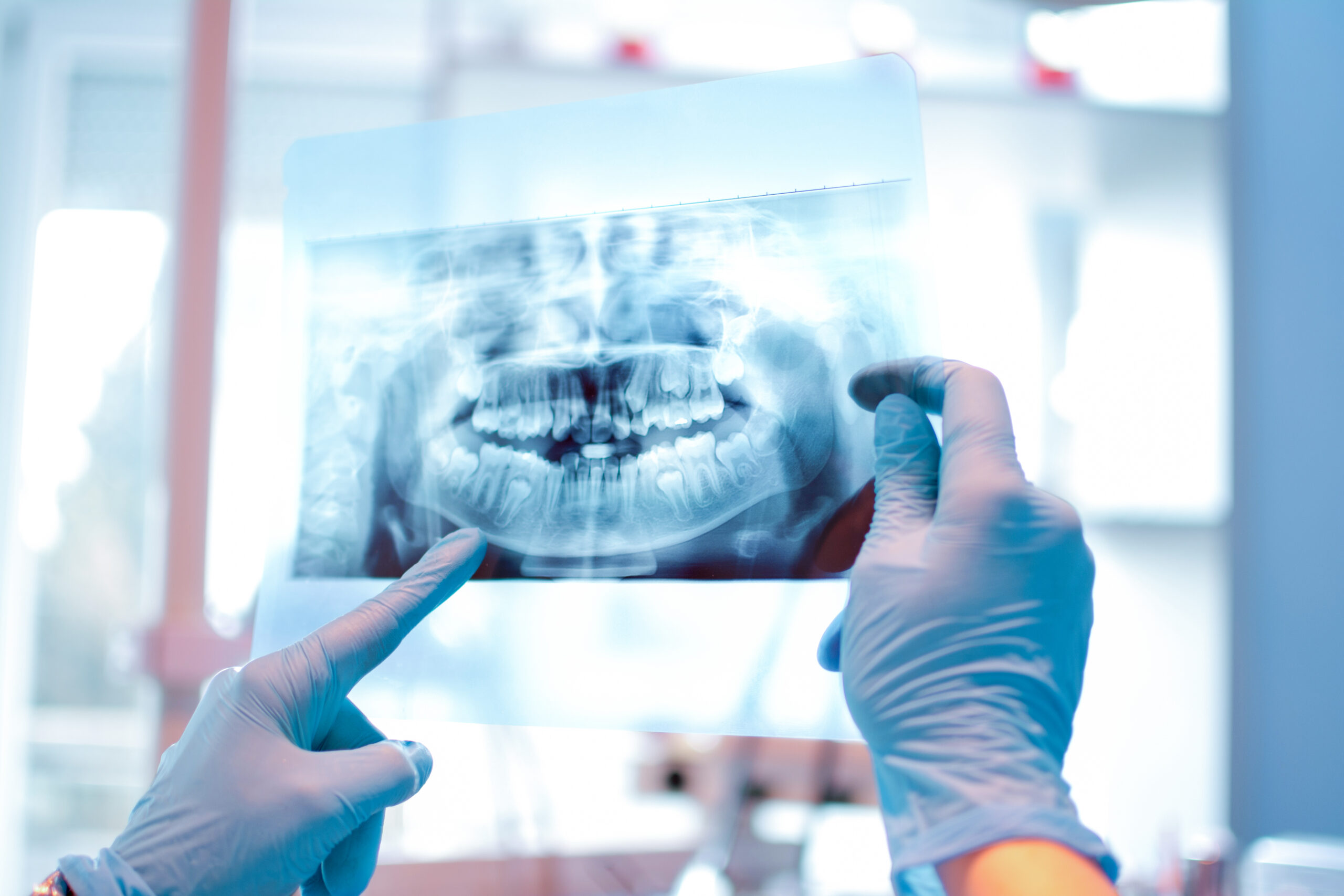Implantes en pacientes jóvenes: protocolos actualizados
