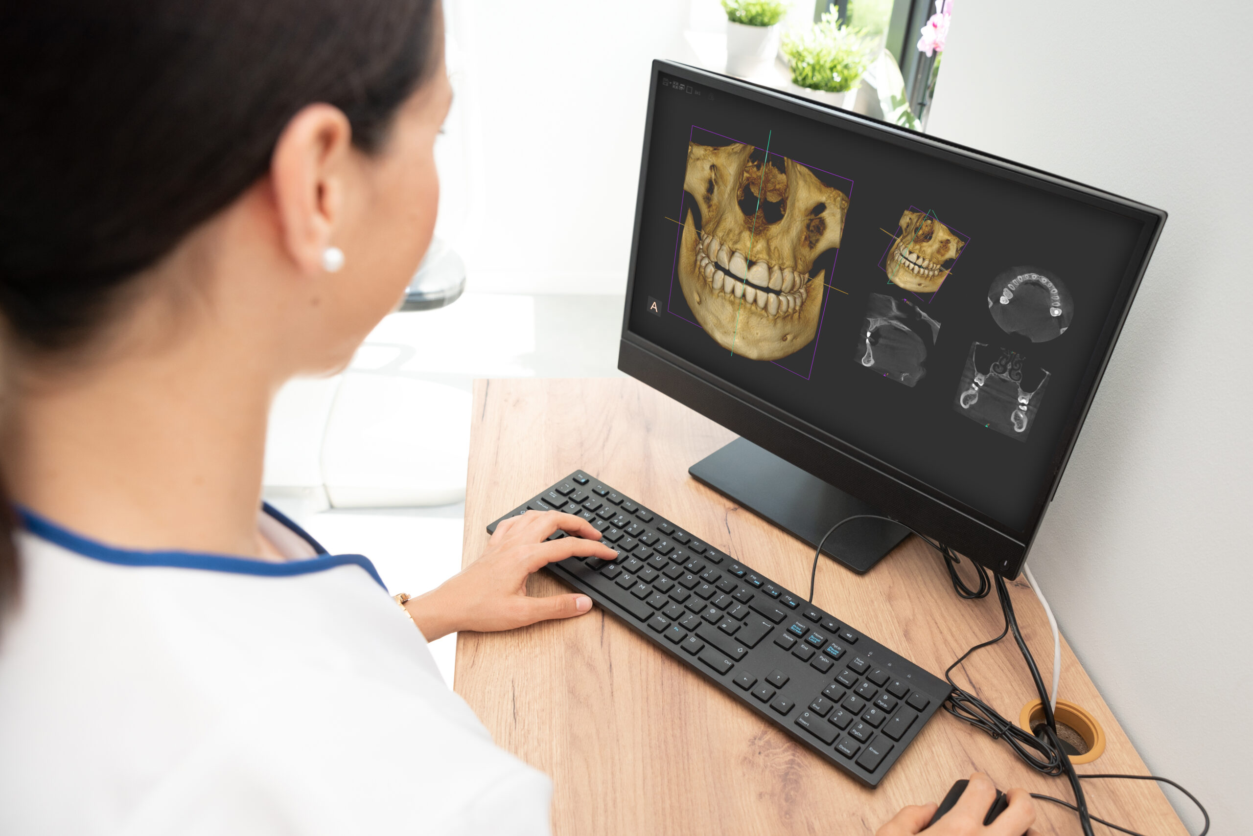 Prótesis sobre implantes: diferencias entre carga inmediata y diferida