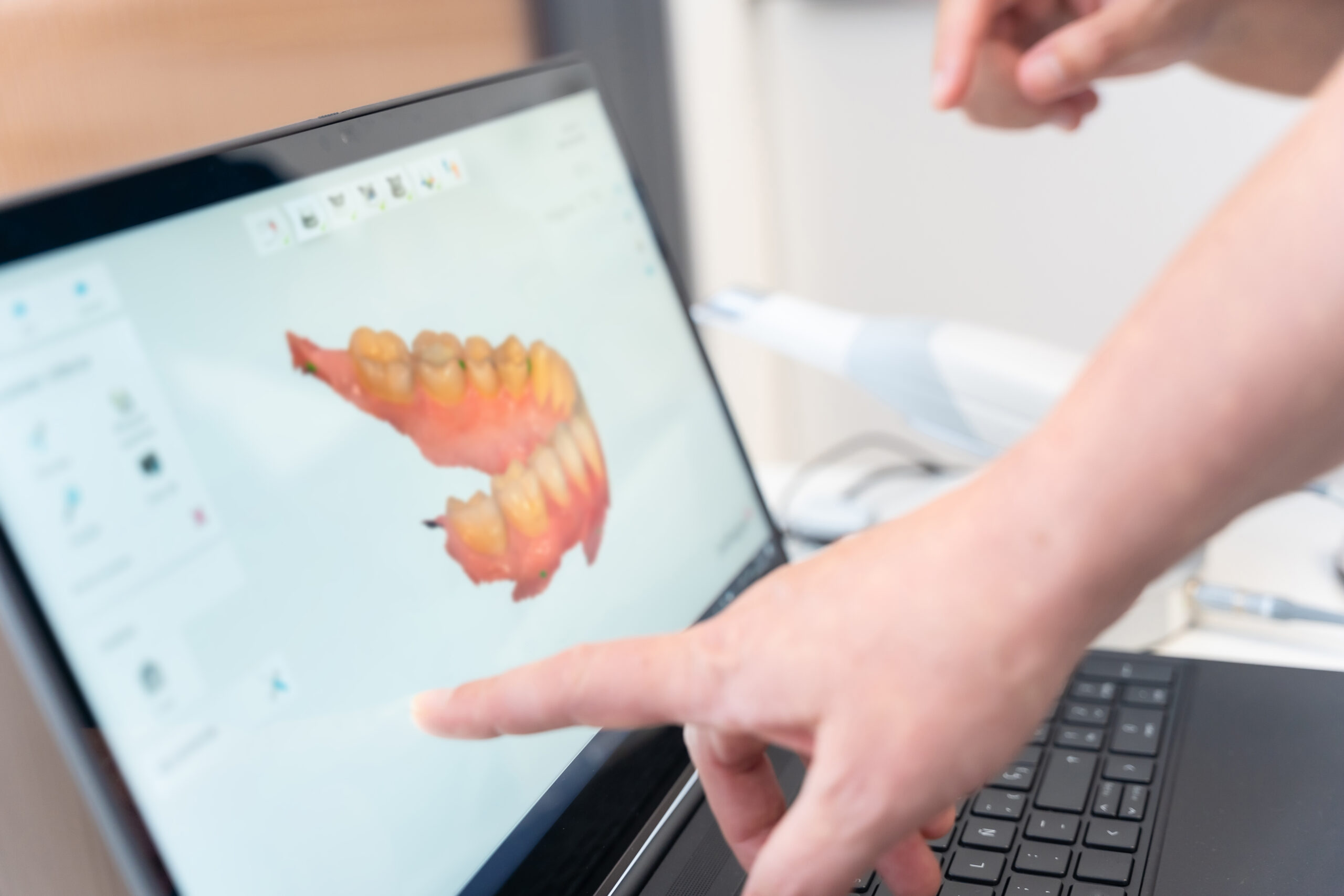 Contorneado estético de encías: 
el detalle que transforma la sonrisa
