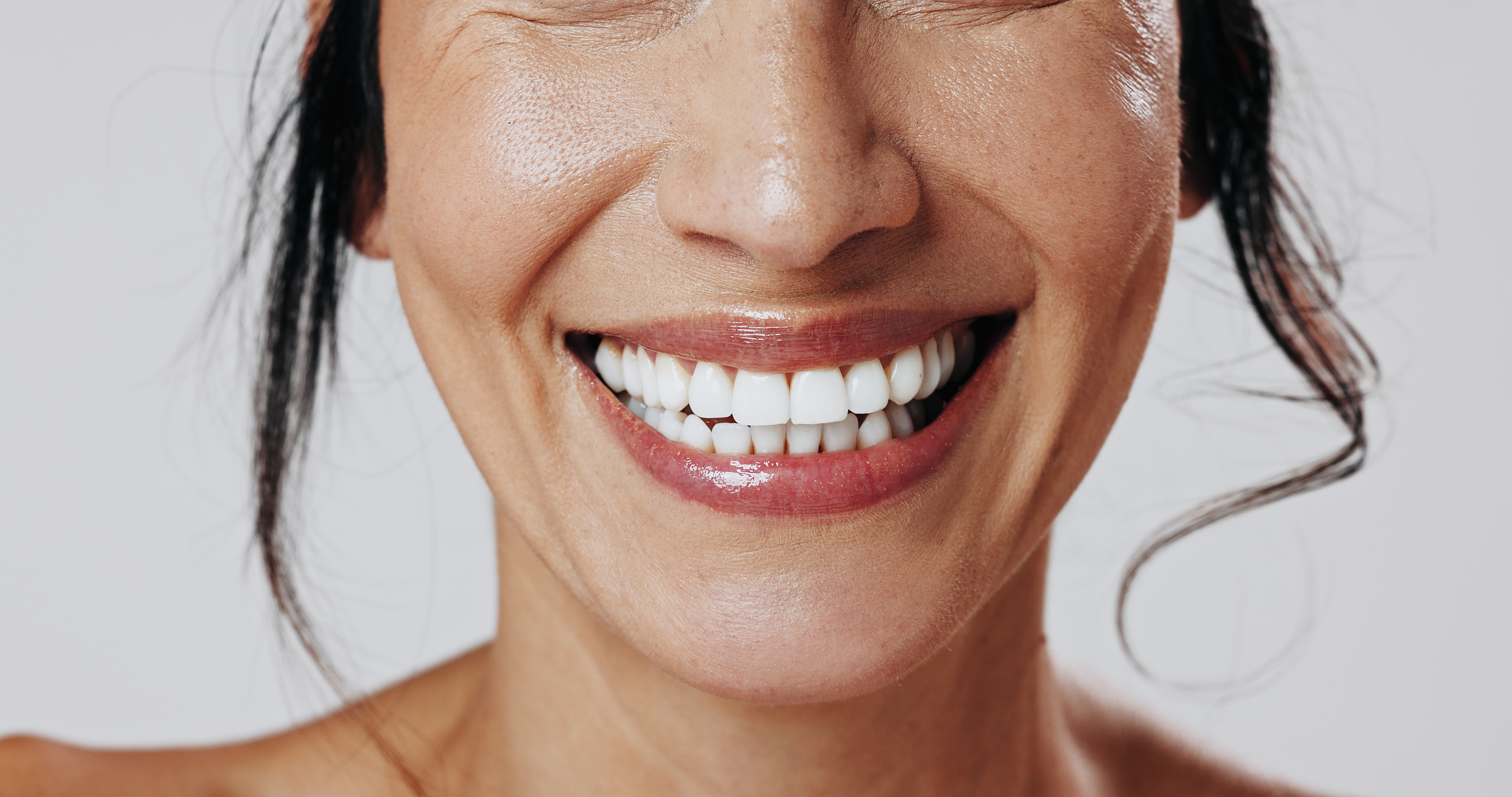 Contorneado estético de encías: el detalle que transforma la sonrisa