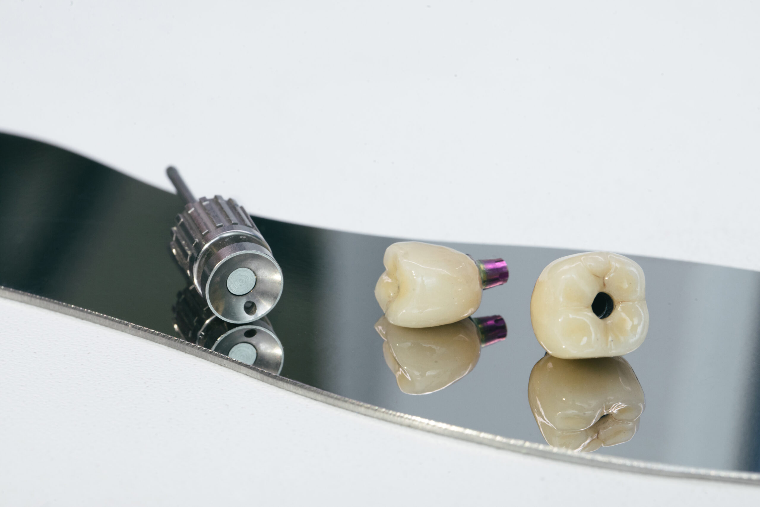 Prótesis completas vs. implantes:
cómo elegir la mejor opción